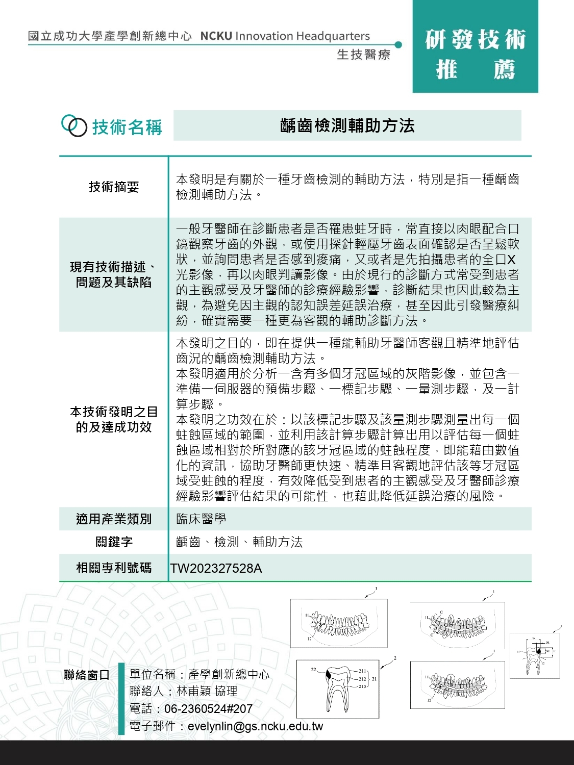 齲齒檢測輔助方法